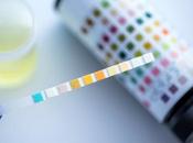 CANCER PROSTATE Vers test urinaire dépistage