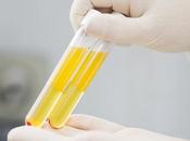 COVID-19 L’option plasma thérapeutique mérite d’être testée