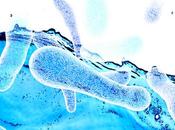 MICROBIOTE CANCER bifidobactéries pour optimiser l’immunothérapie