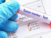 CANCER PROSTATE Pourquoi certains sont plus agressifs
