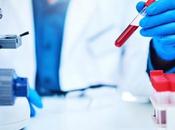 CANCER PANCRÉAS test sanguin plus précis l'imagerie
