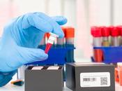 COVID-19 réponse immunitaire varie considérablement d'un patient l'autre