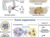 #Cell #cancer #malignité Changements Topologiques Grande Échelle Restreignent Progression Malignité Cancer Colorectal