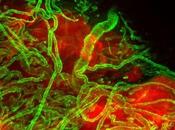 CANCER cellules cancéreuses kidnappent vaisseaux pour métastaser