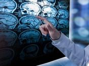 COVID-19 troubles neurologiques chez patient
