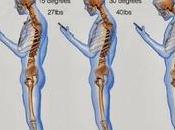 TMS, douleurs cervicales, tendinites… évitez smartphones vous détruisent physiquement