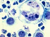 MACROPINOCYTOSE Comment cellules cancéreuses tentent sauver leur peau