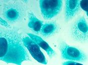 PARADOXE l’OBÉSITÉ survie prolongée dans cancer prostate avancé