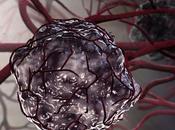 CANCER POUMON anti-angiogéniques aussi efficaces mais moins coûteux