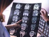 ALZHEIMER début maladie, microglie faim sucre