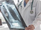 TUBERCULOSE CLO-FAST l’espoir traiter mois