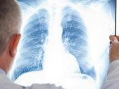 ANTIBIORÉSISTANCE Face plusieurs bactéries, antibiotiques perdent efficacité