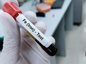 HÉMOCHROMATOSE complications hépatiques prédites l'arthrite