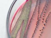 INFECTION URINAIRE métamorphose bactérie long