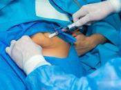 CHIRURGIE BARIATRIQUE Plus efficace mode contre diabète