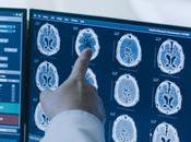 PARKINSON incidence s’accélère