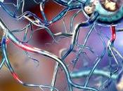 SCLÉROSE PLAQUES Quand l’obésité vient s’ajouter