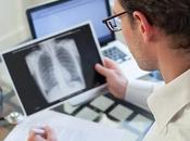 CANCER POUMON défis spécifiques pour l’immunothérapie