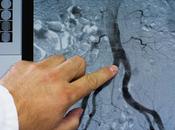 MALADIE CORONARIENNE Premiers gènes risque identifiés