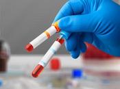 DIABÈTE TYPE test tout simple pour identifier risque dans